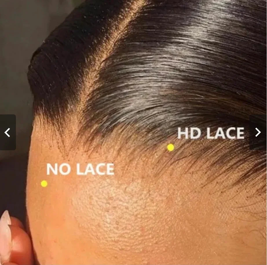 FRONTALS