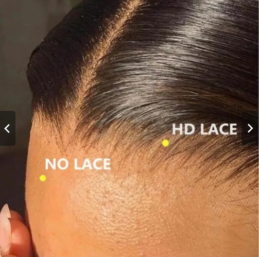 FRONTALS